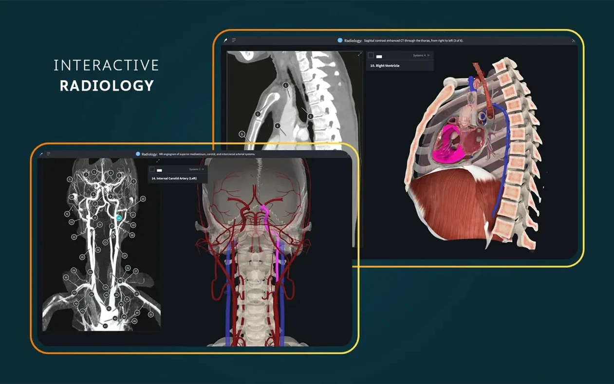 Complete Anatomy UI, 7 of 8 Complete Anatomy feature view 7